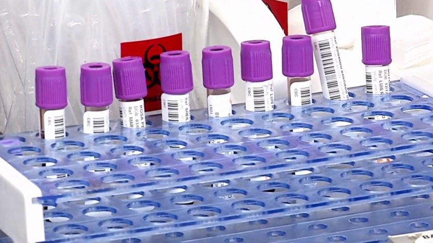 Salud no tiene suficientes pruebas moleculares para sustituir las serológicas retiradas
