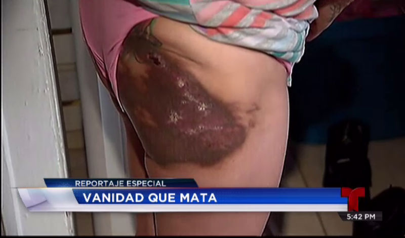 24052015-telenoticias-vanidad