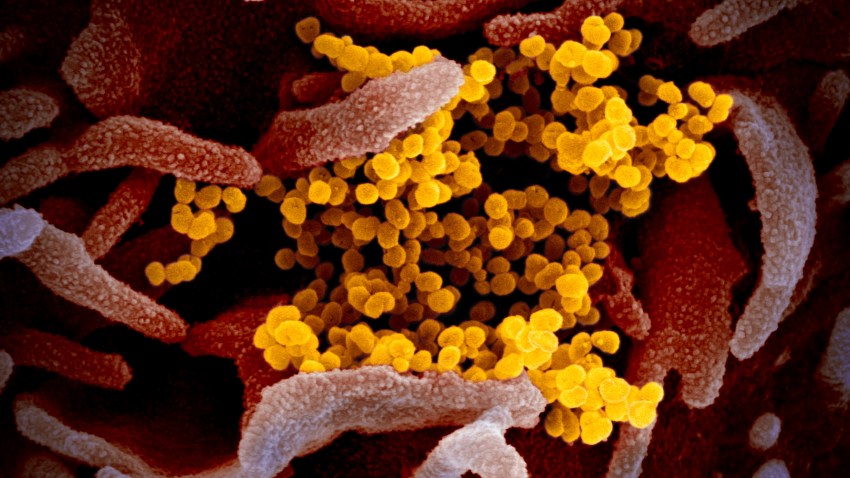 The SARS-CoV-2, the virus that causes COVID-19, or the coronavirus, as seen in this image emerging from lab grown cells. The virus was isolated from a patient from the United States.