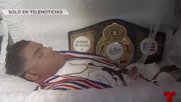 herido_bala_345