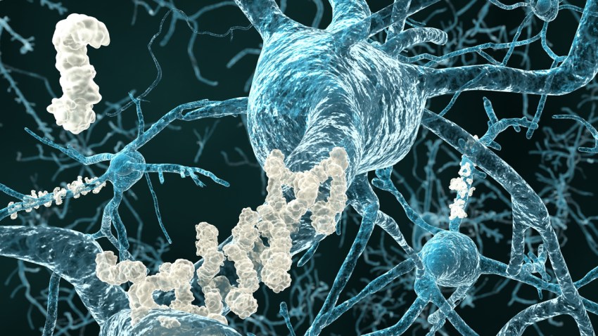 alzheimer-enfermedad-thumbnail