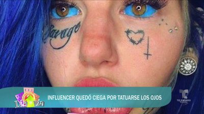 Queda ciega por tatuarse ojos de azul
