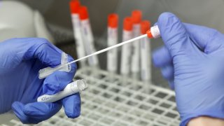 A lab technician is working on smears for PCR tests for Covid-19 during the coronavirus pandemic