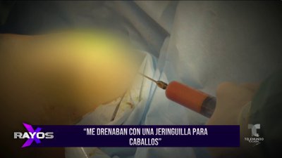 El lado oscuro de la belleza: muchos los riesgos de los procedimientos estéticos mal realizados