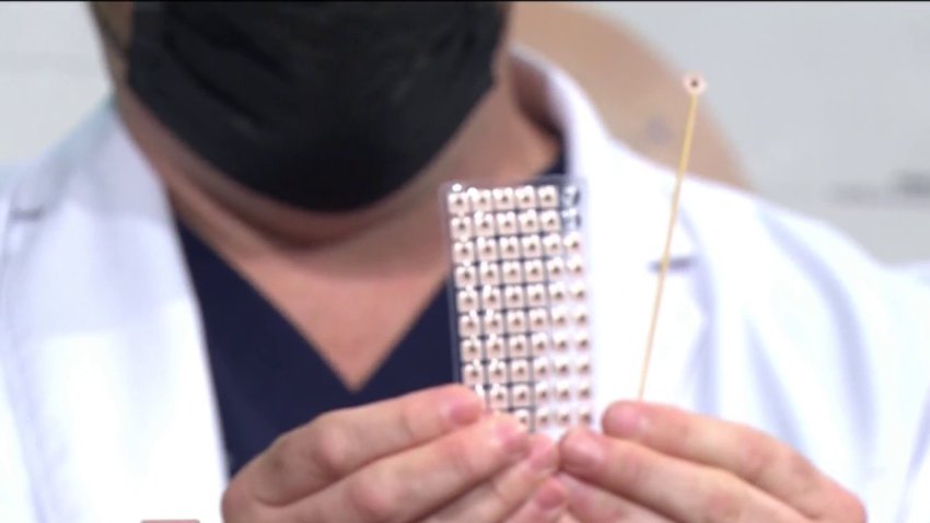 ¿Cómo combatir las neuropatías provocadas por la diabetes con la acupuntura?