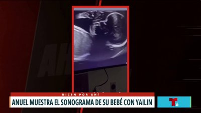 Anuel AA muestra sonograma de su bebé con Yailín La Más Viral
