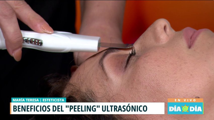Beneficios del “peeling” ultrasónico