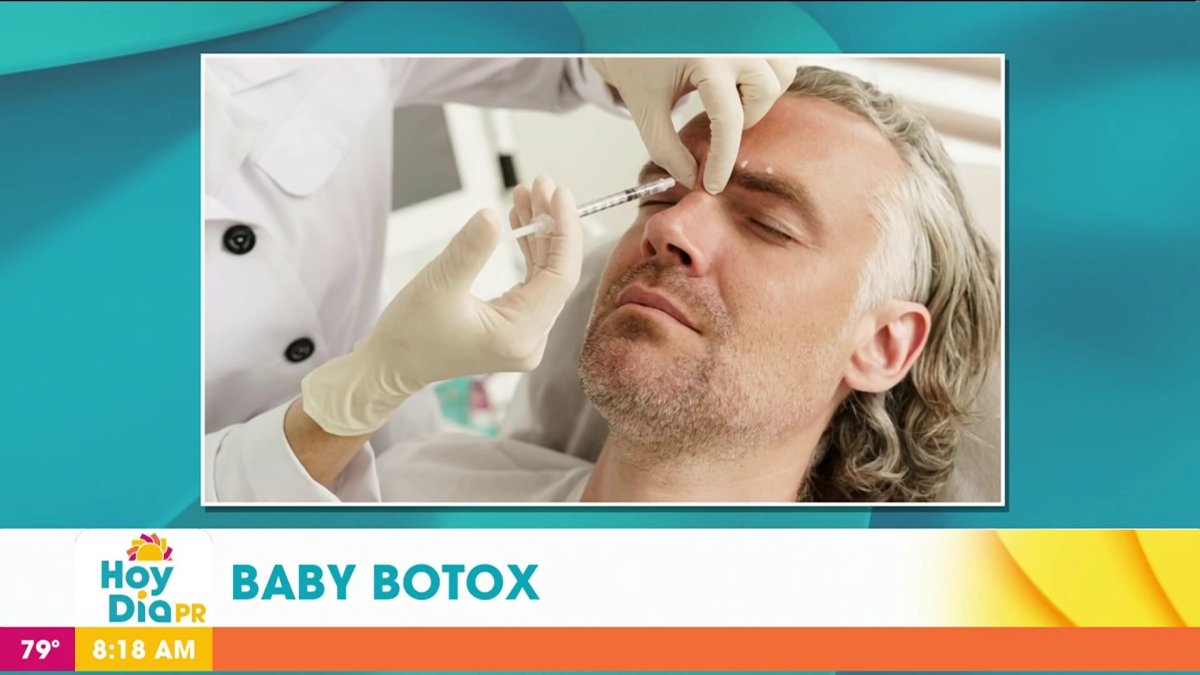 Qué es el “baby botox” Telemundo Puerto Rico
