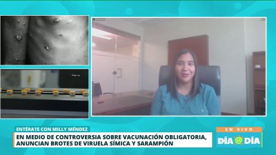 Alertan sobre brote de viruela símica en la Isla