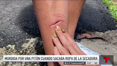 Mujer narra cómo fue atacada por una culebra en Bayamón