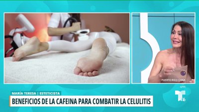 La cafeína para combatir la celulitis