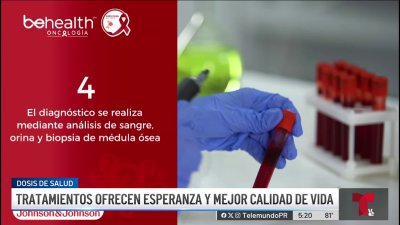 Aumenta la prevalencia del mieloma múltiple