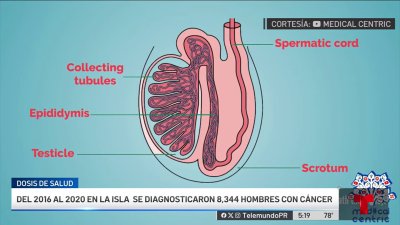 Varones: importante tocarse los testículos a partir de los 15 años