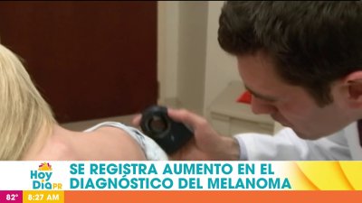 Cáncer de piel: cómo identificar las primeras señales