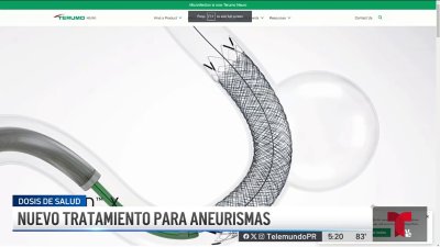 Nuevo tratamiento para aneurismas