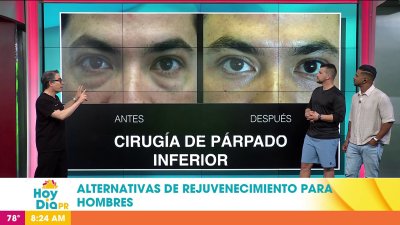 Alternativas de rejuvenecimiento para hombres
