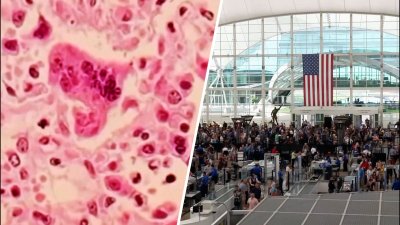 ¿Vas a viajar? Los CDC urgen que te vacunes contra el sarampión