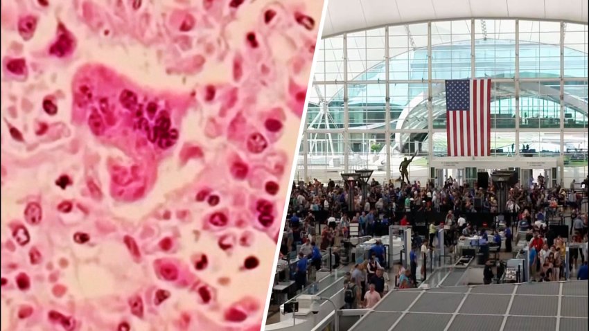 ¿Vas a viajar? Los CDC urgen que te vacunes contra el sarampión