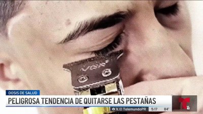 Peligrosa tendencia: afeitarse las pestañas podría causar infecciones y condiciones