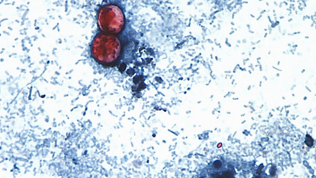 Brote de ciclosporosis expone fallas de la FDA en inspecciones de alimentos importados